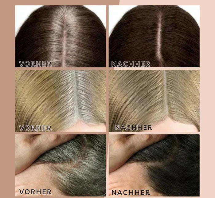 Líneas de cabello perfectas en todo momento | 1+1 GRATIS