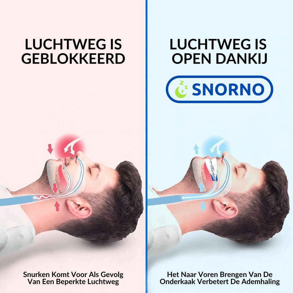 Anti-Snurk Beugel | Fácil de usar y confort premium