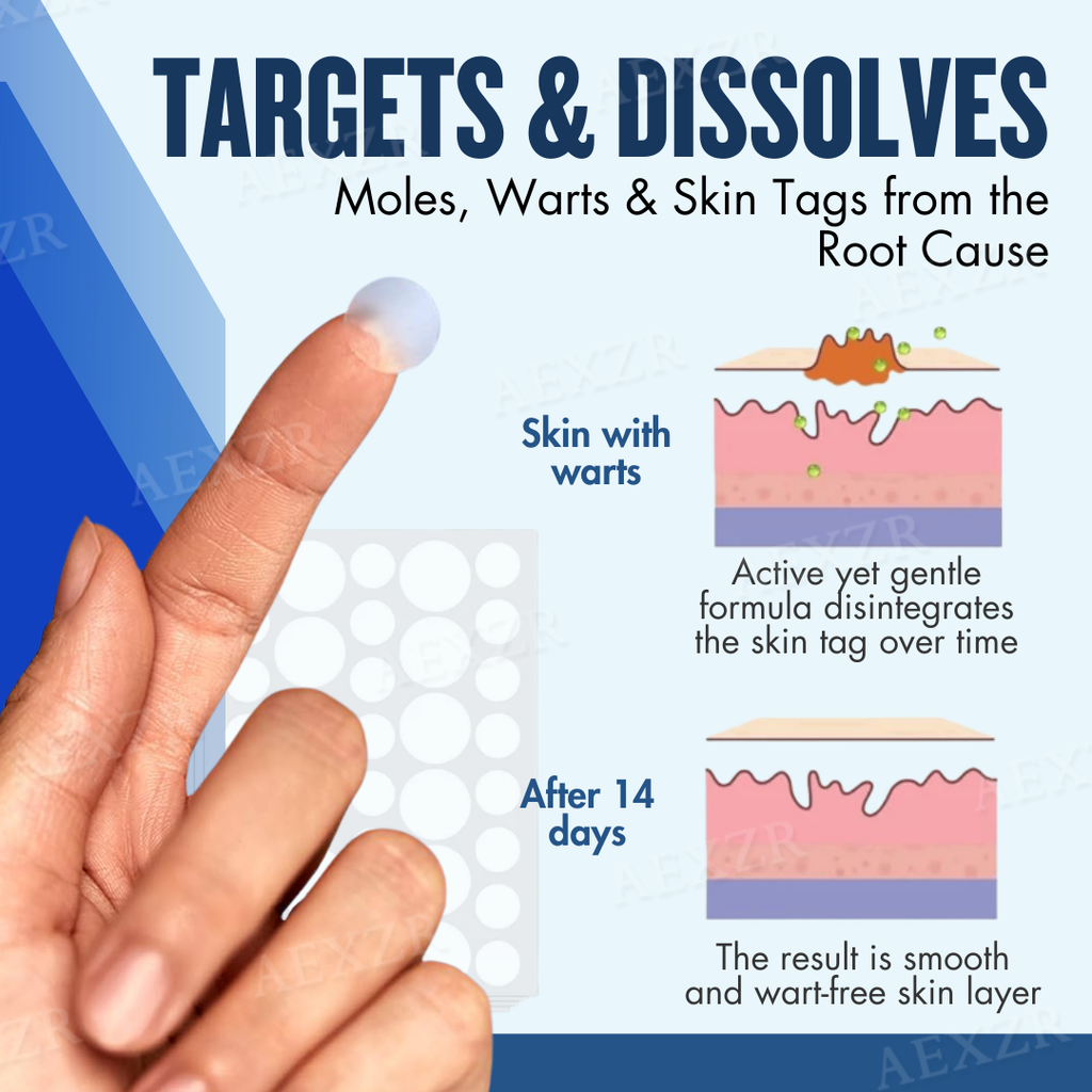 Parche – Eliminación efectiva de manchas de belleza y verrugas