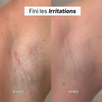 Depilador exfoliante suave
