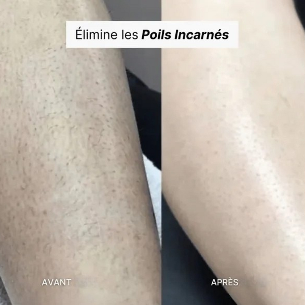 Depilador exfoliante suave