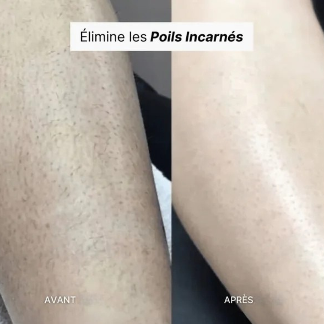 Depilador exfoliante suave