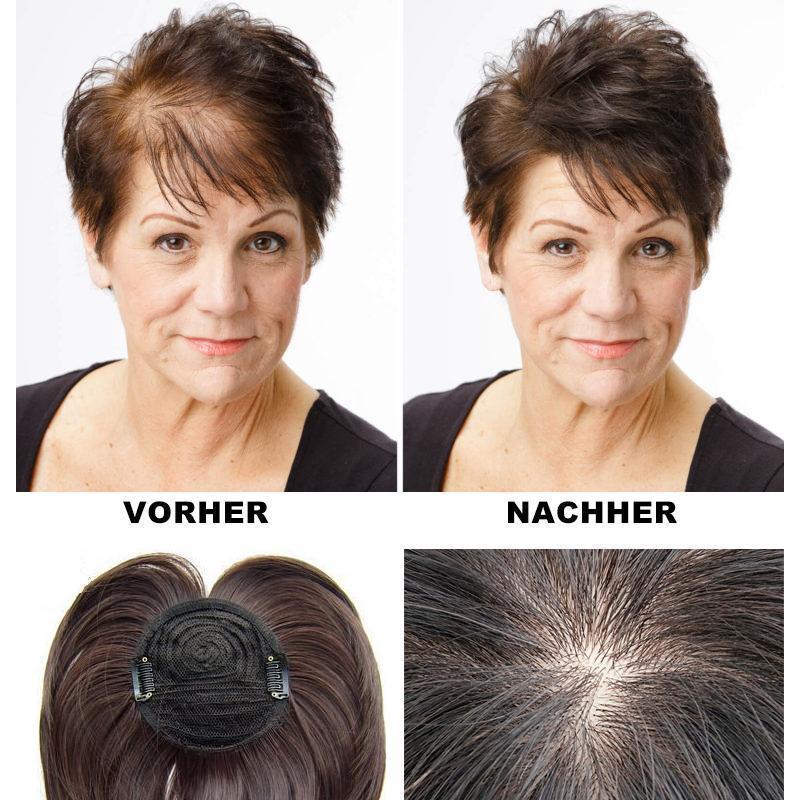 Kalsten | Pieza de cabello especial
