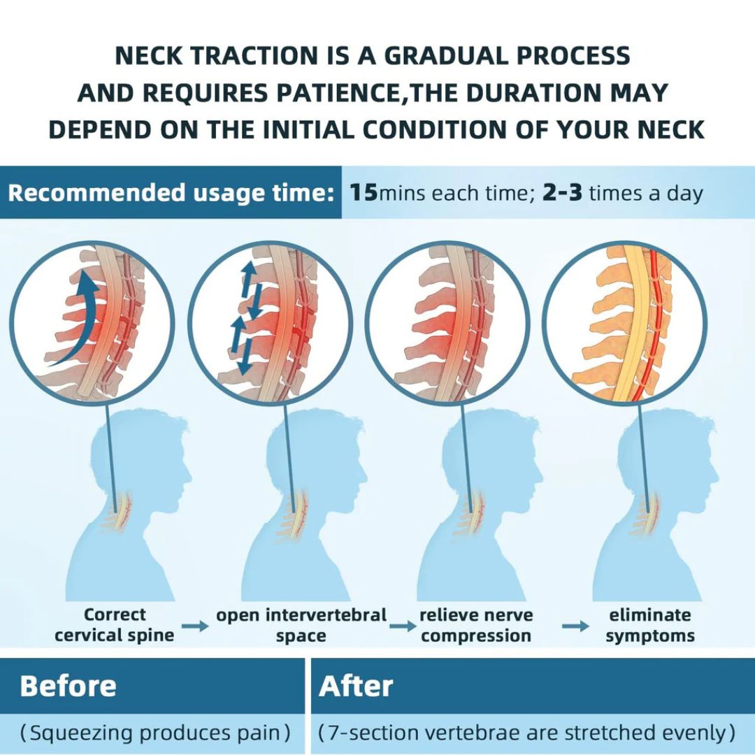 Lisslune | Estirador de Cuello para Alivio del Dolor - Dispositivo de Tracción Cervical Ajustable Ideal para la Tensión y el Incomodidad del Cuello