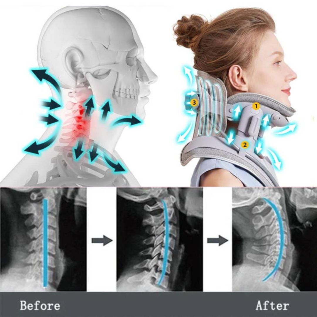 Lisslune | Estirador de Cuello para Alivio del Dolor - Dispositivo de Tracción Cervical Ajustable Ideal para la Tensión y el Incomodidad del Cuello