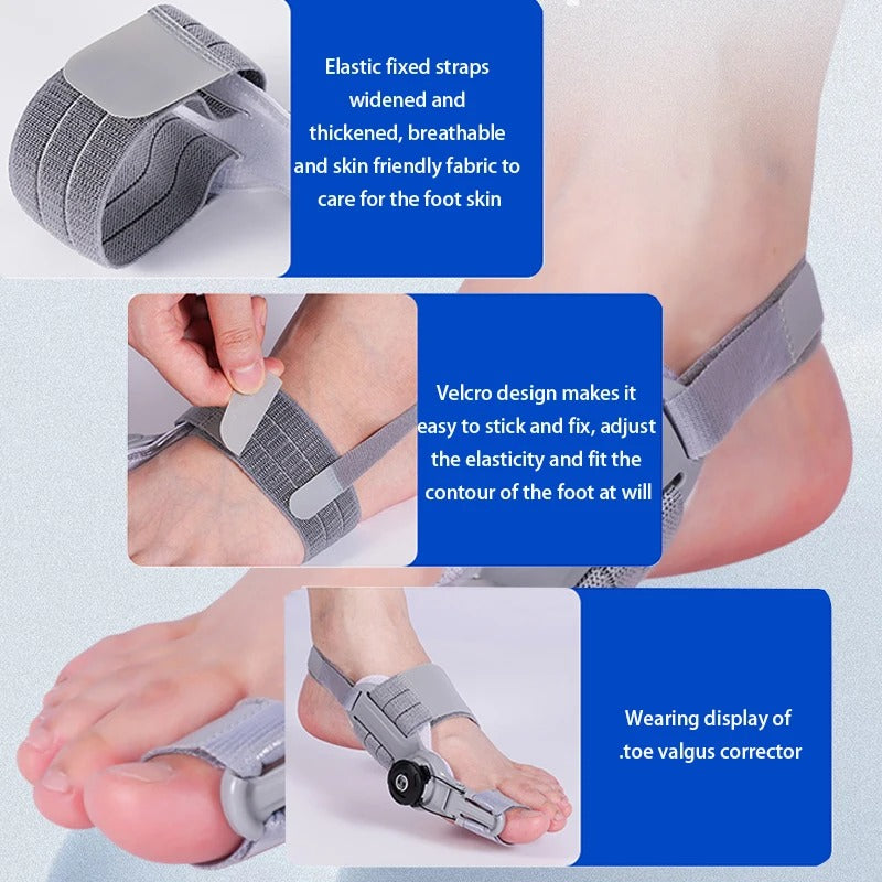 Férula Ajustable BunionEase para el Dolor de Hallux Valgus