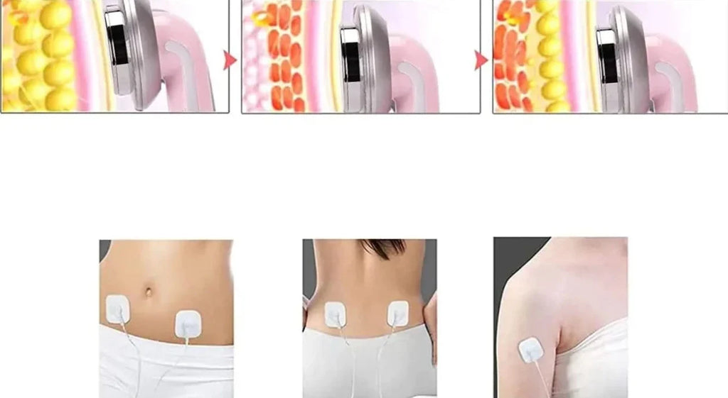 Máquina de Cavitación Ultrasónica para el Cuerpo