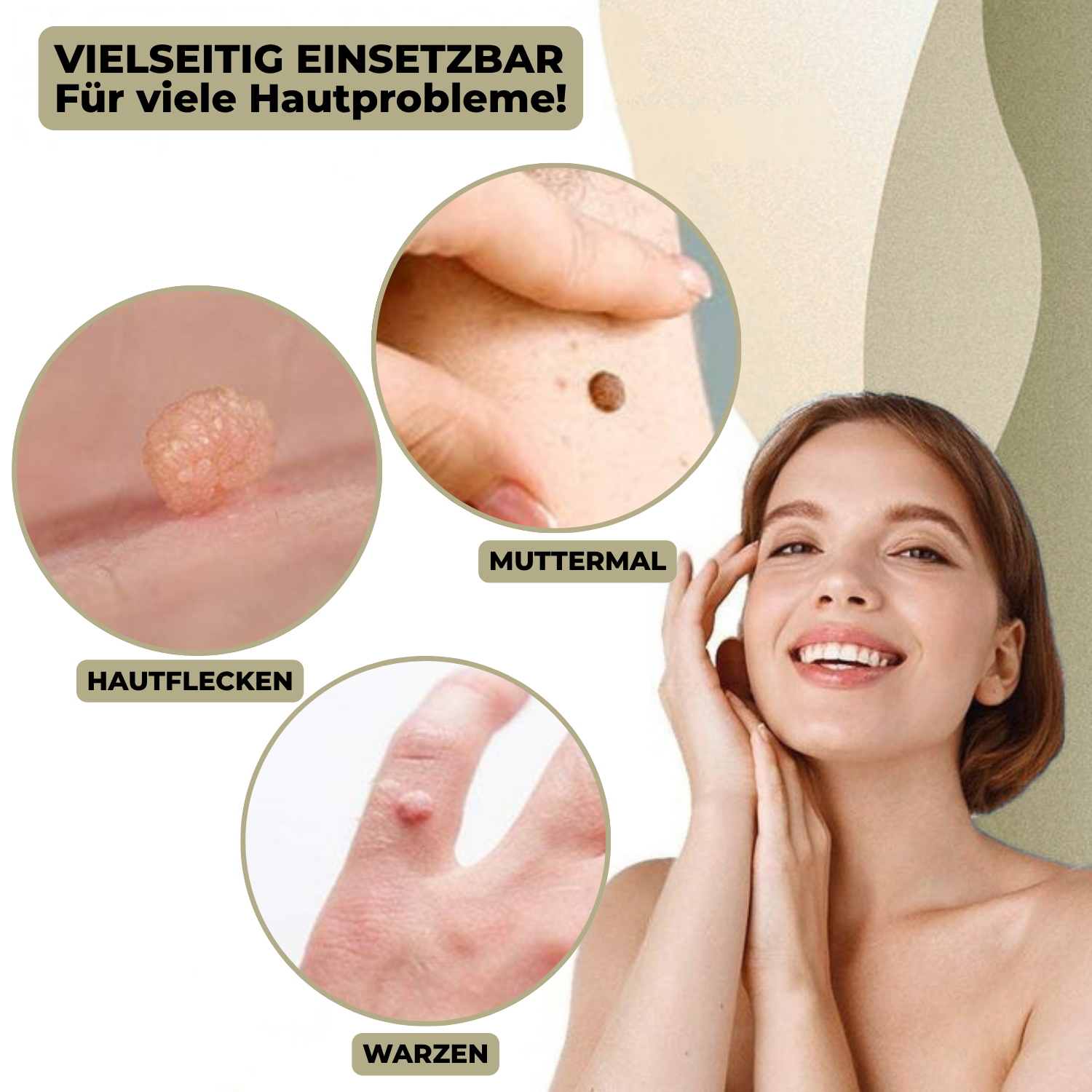 Kalsten | DermaLinx Removedor de Verrugas | Eliminación Sin Dolor de Verrugas y Lunares | Para Uso en Casa | Sin Cirugía