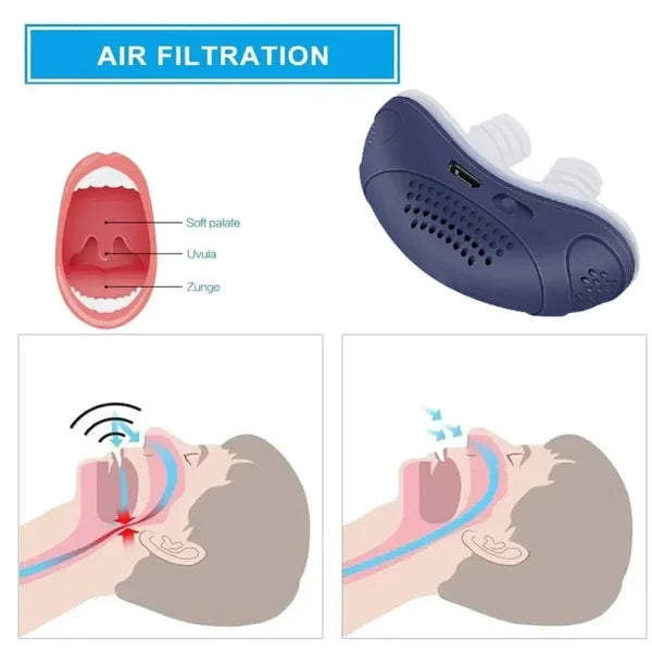 Schlaflos, sin máscara, Micro-CPAP Anti-Ronquidos