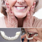 Carillas On Smile (incluye maxilar superior e inferior)