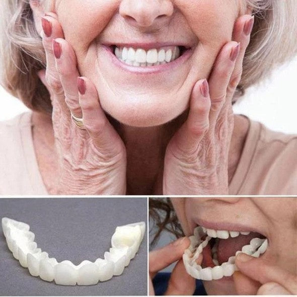 Carillas On Smile (incluye maxilar superior e inferior)
