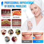 SONIC TOOTHBRUSHES™ – Limpieza dental profesional en casa