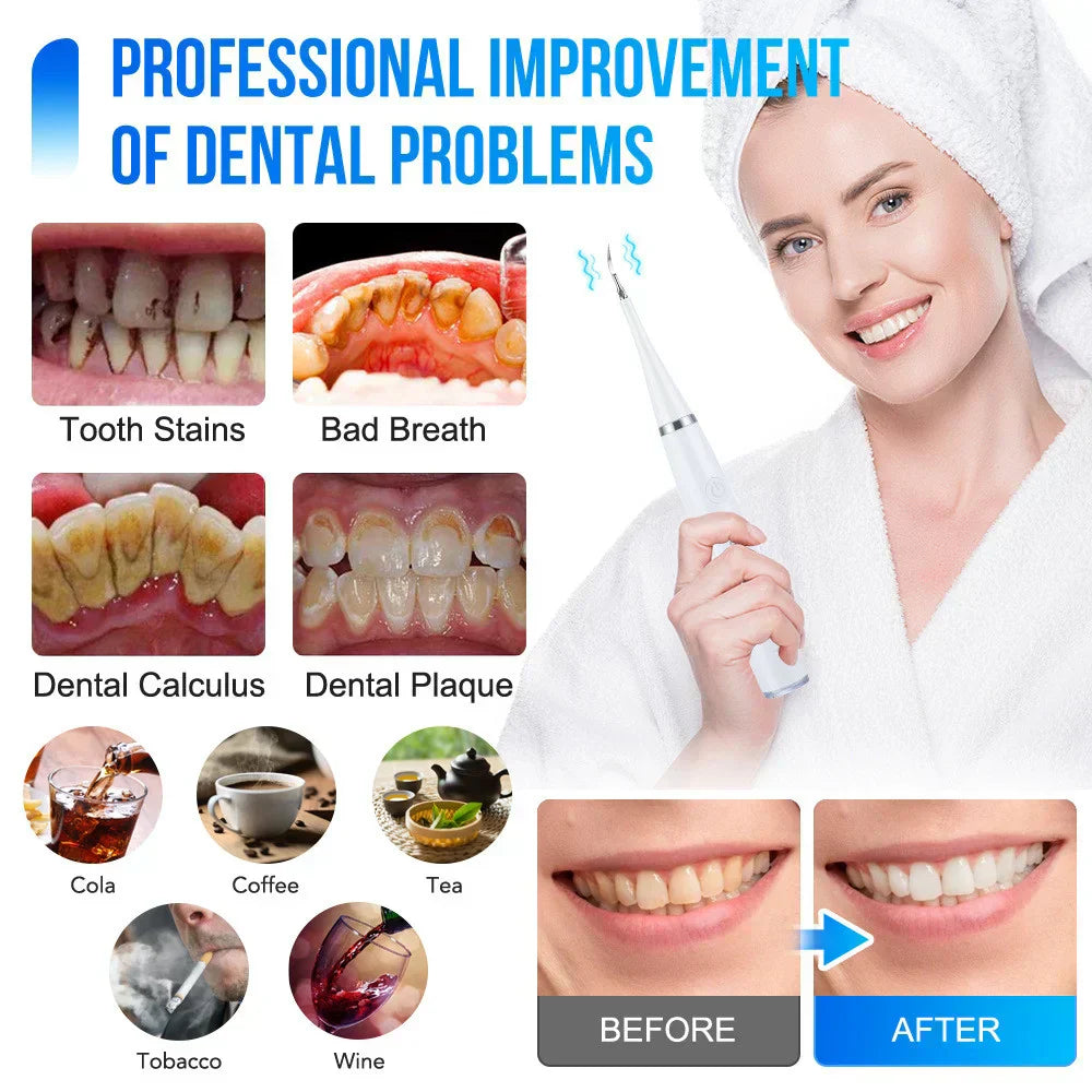 SONIC TOOTHBRUSHES™ – Limpieza dental profesional en casa