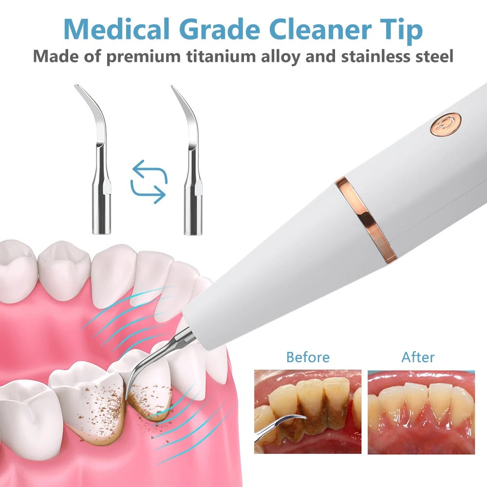Removedor de Placa Ultrasónico - Dispositivo de Limpieza Dental Profunda