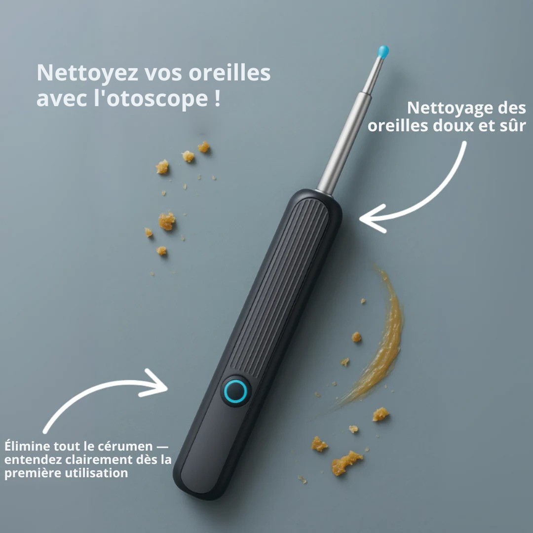 Otoscopio vídeo HD