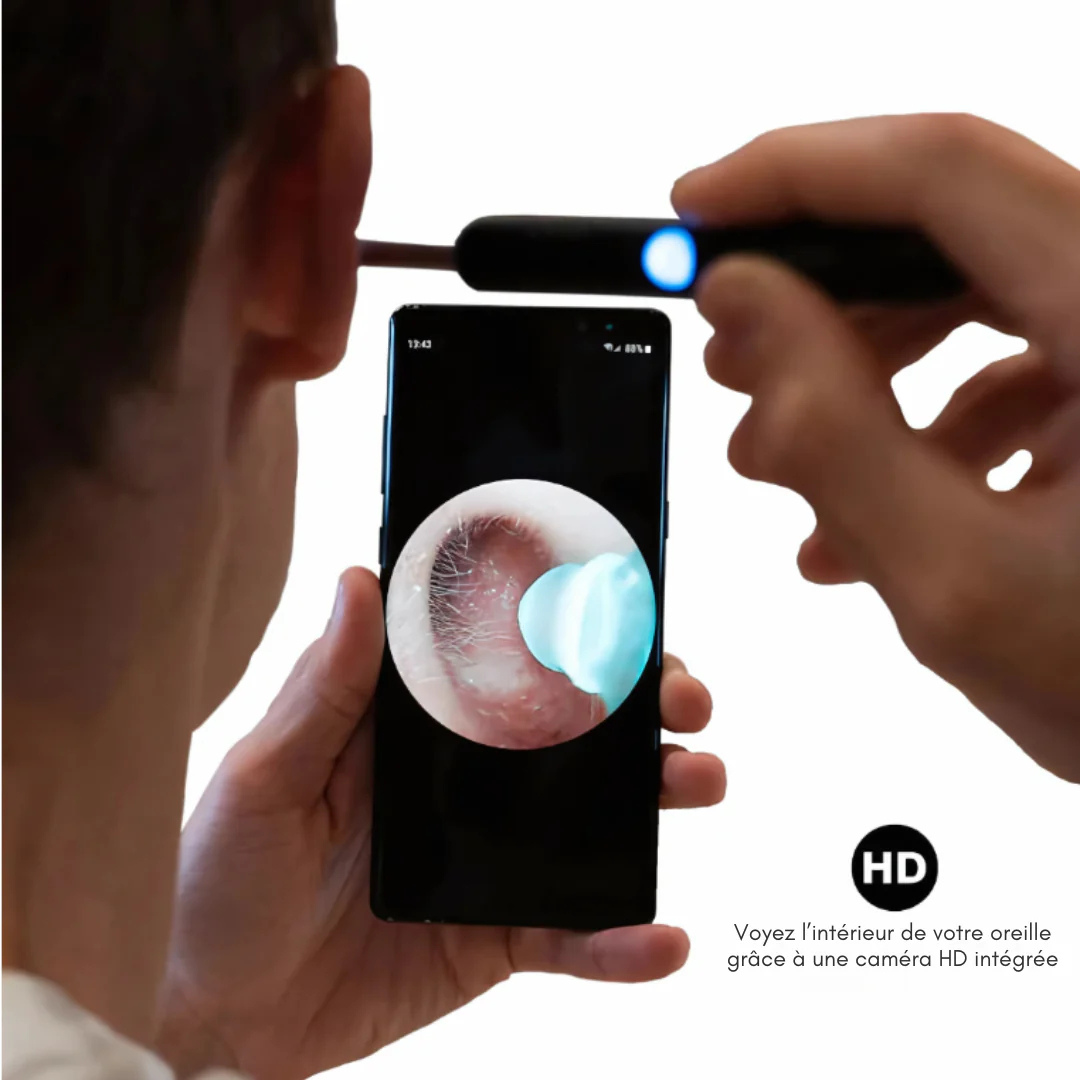 Otoscopio vídeo HD