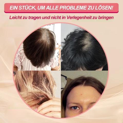Kalsten | Pieza de cabello especial