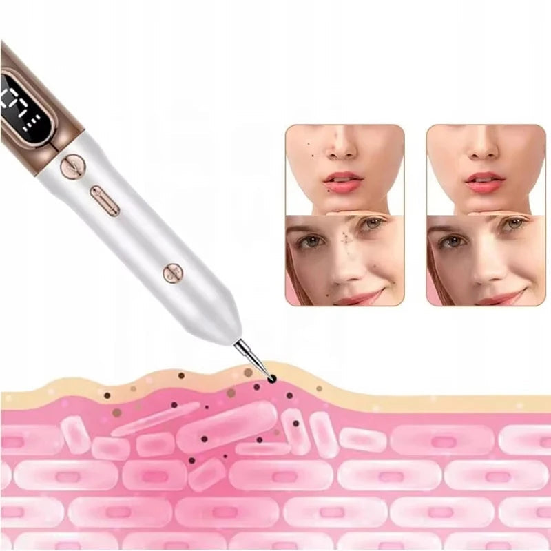 Plasma Pen Para Eliminar Etiquetas de Piel, Lunares y Manchas
