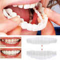 Carillas On Smile (incluye maxilar superior e inferior)