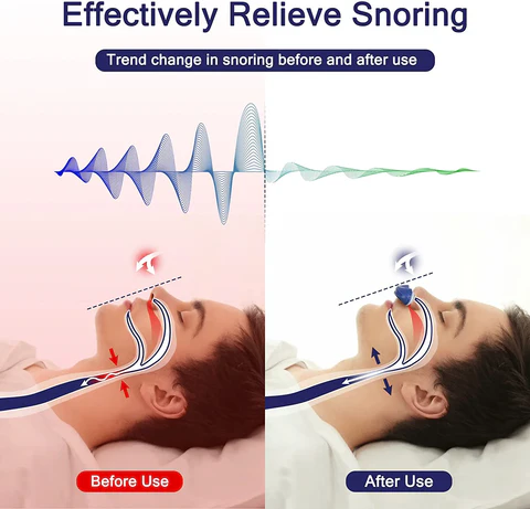 Micro CPAP máquina para apnea del sueño para viajes y anti-ronquidos - Alternativa a CPAP