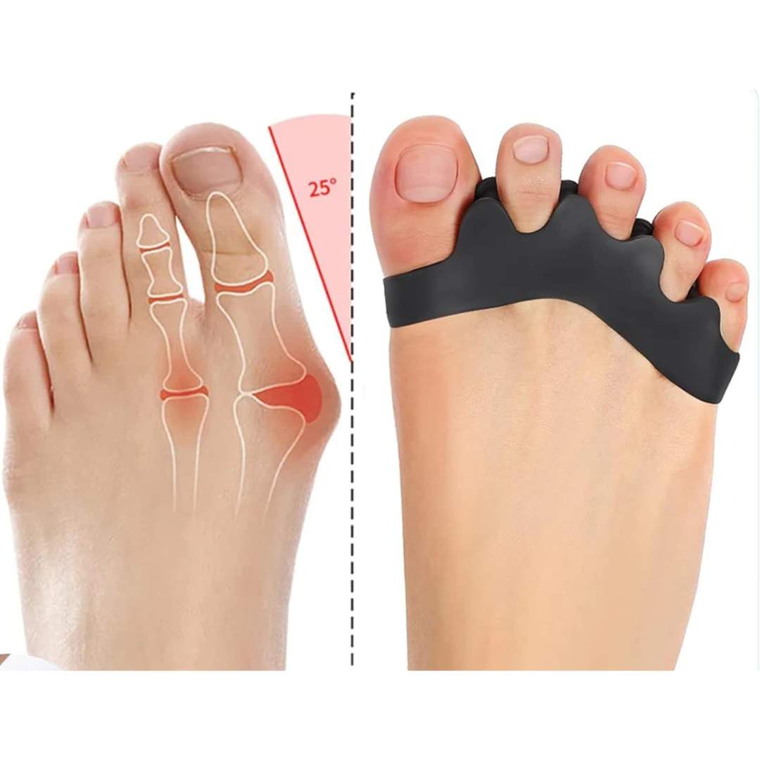 Separador de Dedos FlexAlign | Realineación de Dedos y Alivio del Dolor – Ideal para Juanetes - Dedos Superpuestos - y Comodidad en los Pies Kalsten