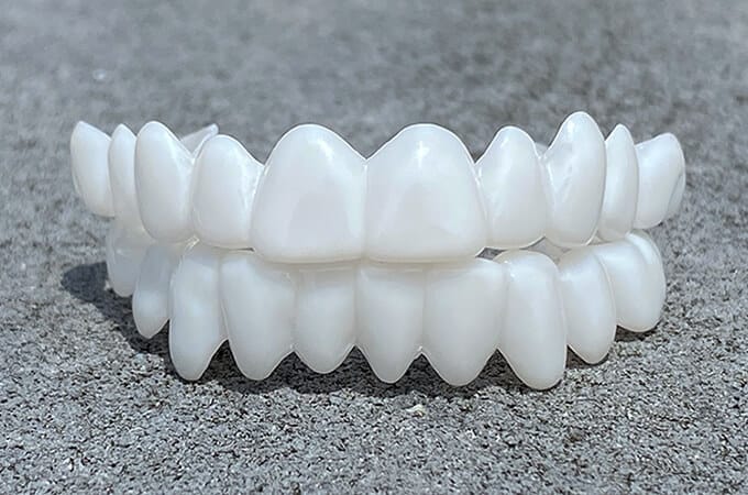 Prótesis dental