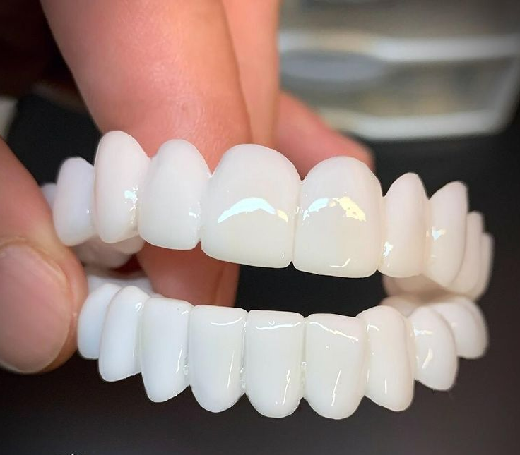 Prótesis dental