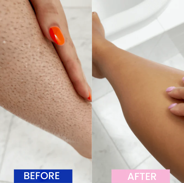 GlowFree – Depilación láser sin dolor para una piel suave y sedosa | 50% DESCUENTO