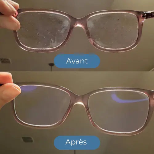 Caja de Desinfección para Gafas