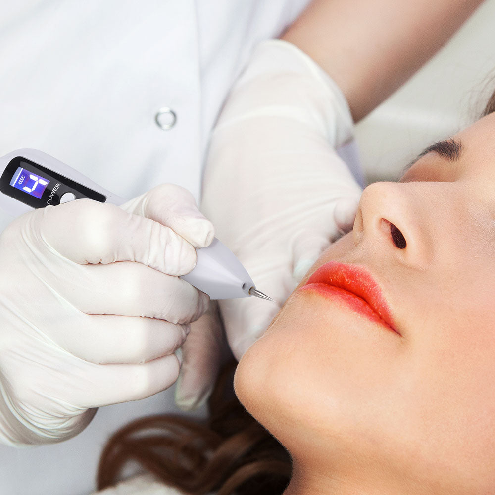 Pluma de Plasma Removedor de Manchas de Piel