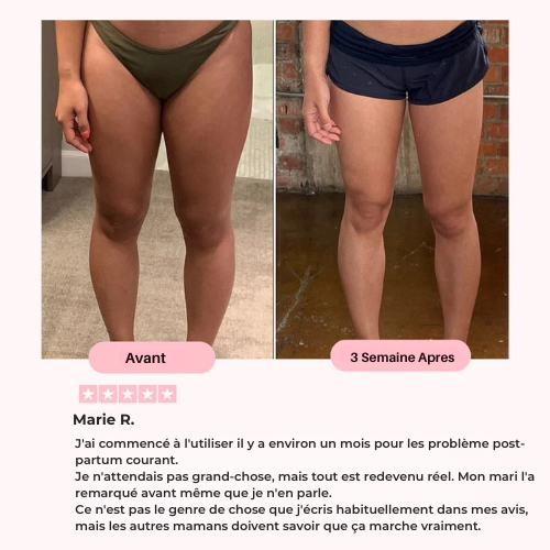 Dispositivo de Rehabilitación Pélvica