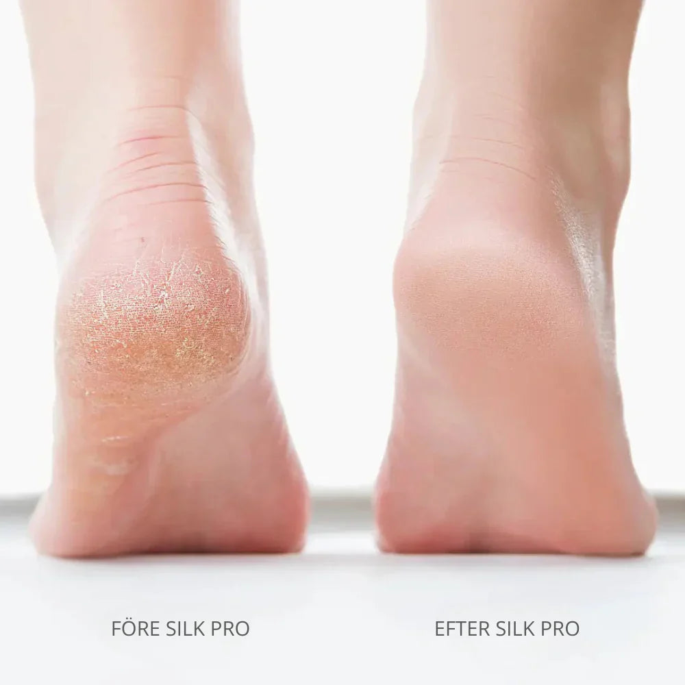 Bliss Silk Pro 2 – Pies suaves sin costosas visitas al salón