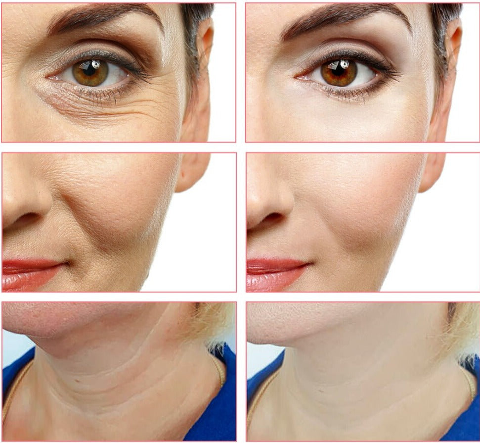 Masajeador Facial Rejuvenecedor