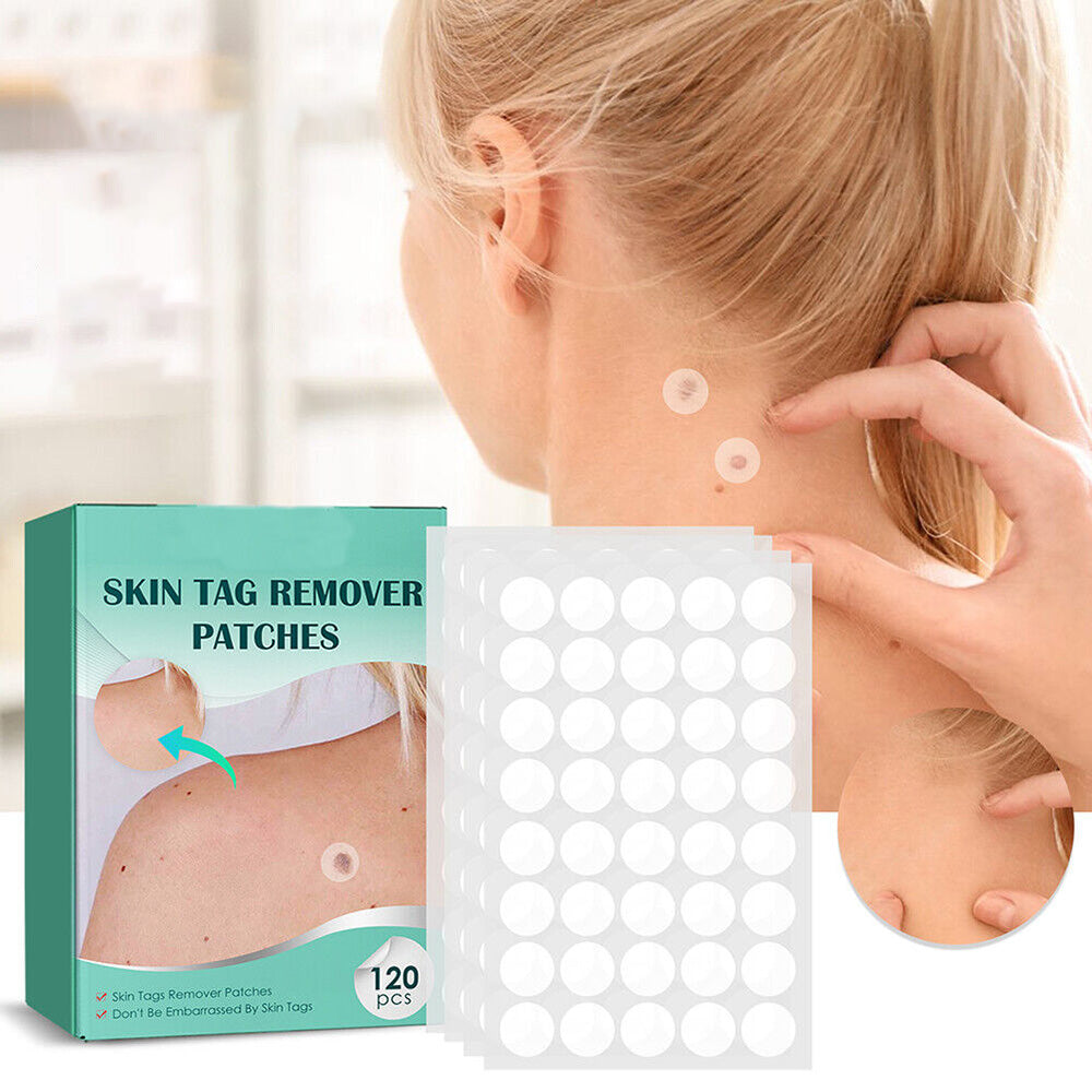 SkinClear - Parche para la eliminación de manchas y verrugas 120 Piezas Parches para la Piel