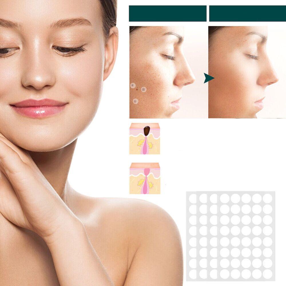 SkinClear Eliminador de Verrugas | Parche para la eliminación de etiquetas de piel y verrugas | Tecnología de hidrocoloides | Sin dolor y discreto | Para todos los tipos de piel | 120 piezas