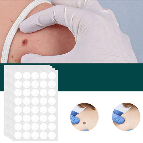 SkinClear Eliminador de Verrugas | Parche para la eliminación de etiquetas de piel y verrugas | Tecnología de hidrocoloides | Sin dolor y discreto | Para todos los tipos de piel | 120 piezas