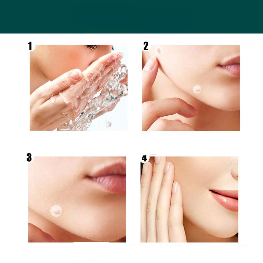 SkinClear - Parche para la eliminación de manchas y verrugas 120 Piezas Parches para la Piel