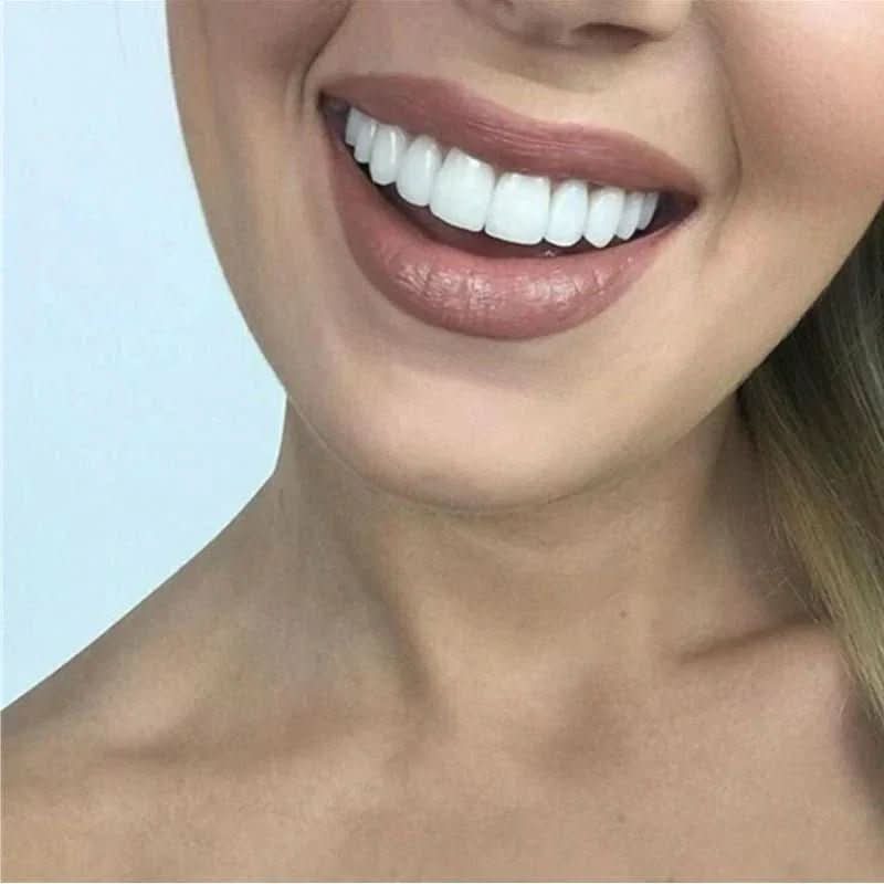 SNAPFIT SMILE – Restauración dental para una sonrisa perfecta sin dentista