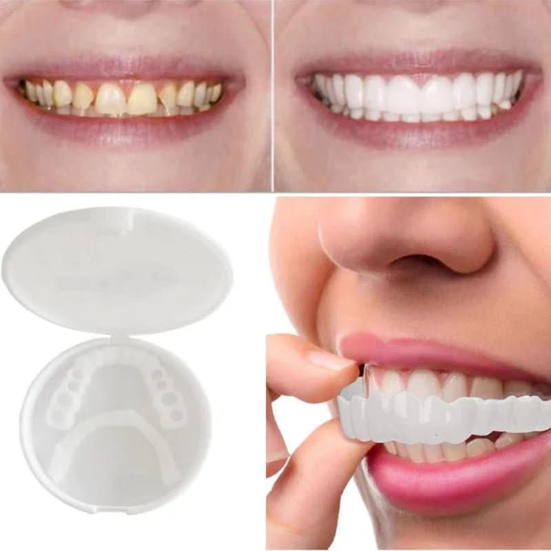 SNAPFIT SMILE – Restauración dental para una sonrisa perfecta sin dentista