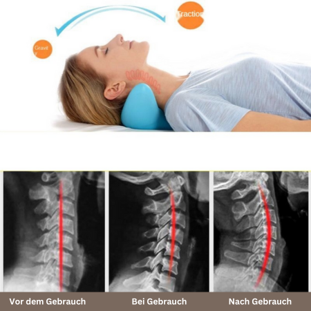 RelaxoFlex™ - Relaja tu cuello | 50% DESCUENTO
