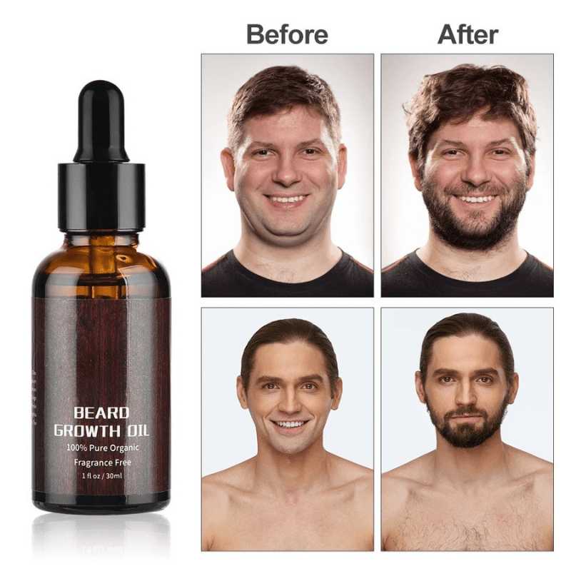 BARTBOOST – Kit de crecimiento de barba para una barba sana y fuerte