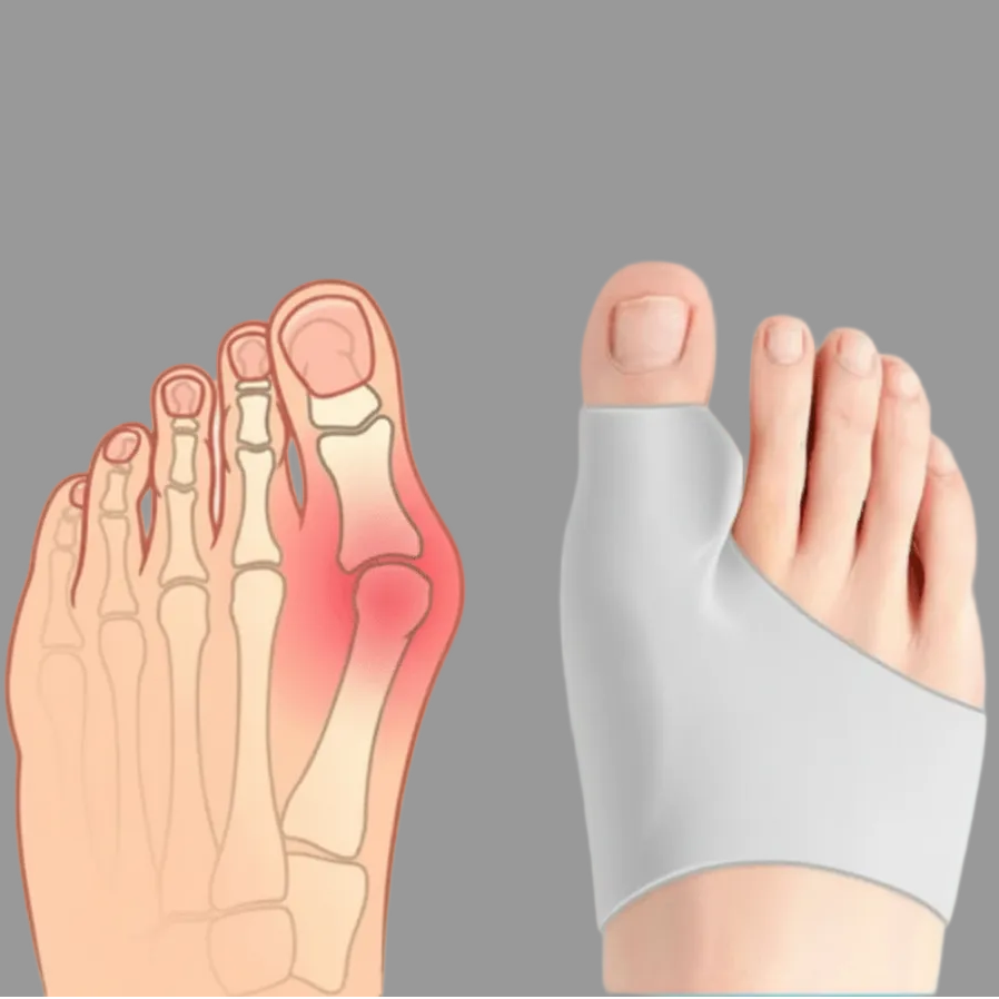 COMPRESSCARE TEEN – Corrector de Hallux Valgus para Adolescentes