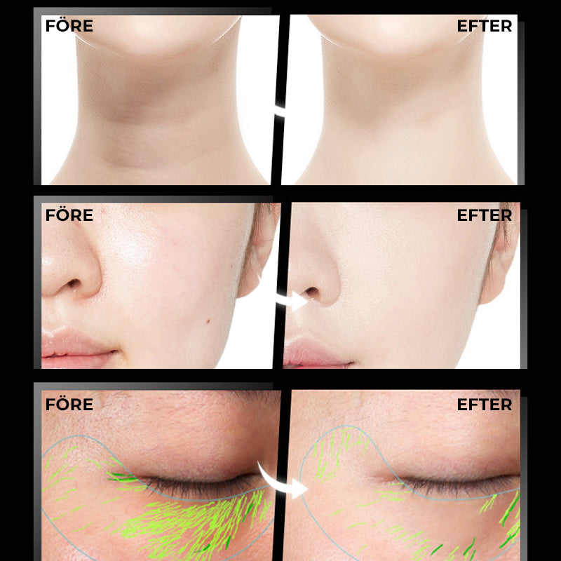 Masajeadores Faciales con Vibración Sónica y Microcorriente para Belleza