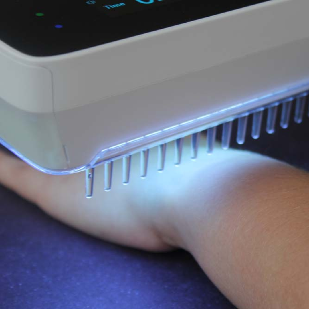 Lámpara de Fototerapia UVB Portátil para Psoriasis y Vitiligo