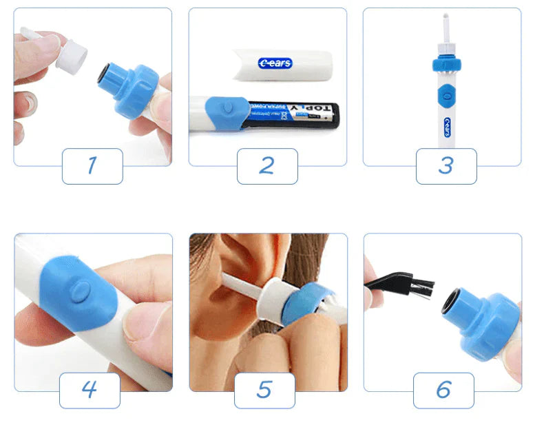 Removedor de Cerumen Eléctrico