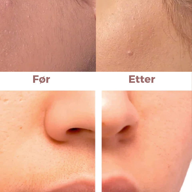 Epilador Facial - Eliminación de Vello Instantánea y Sin Dolor