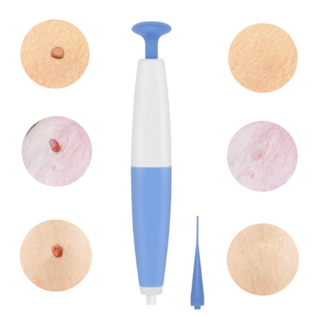 Kit de Eliminación de Verrugas Cutáneas Efectivo
