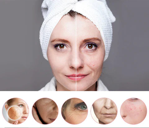 Masajeador Facial Rejuvenecedor