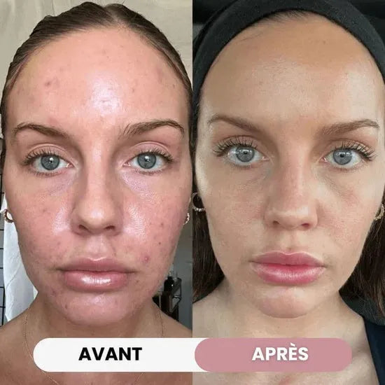 Escultor facial 7-en-1