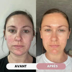 Escultor facial 7-en-1